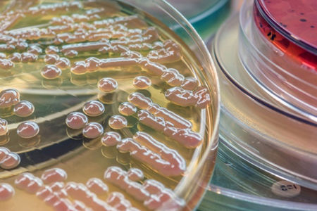 csm_bacteria_agar_plates_75932f9051