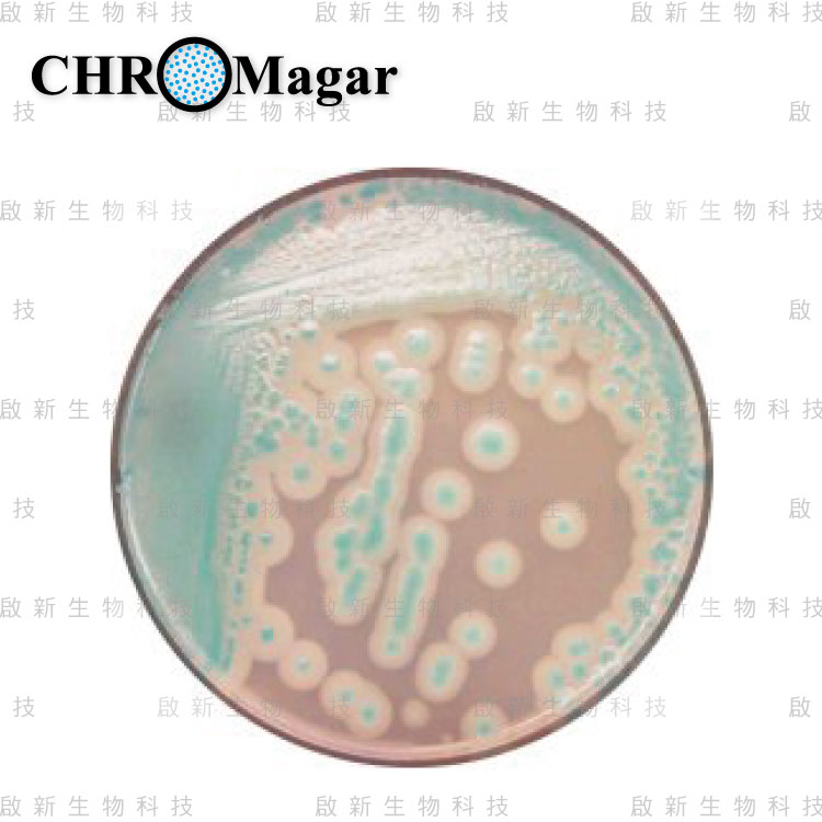 web_ChroMagar_B.cereus