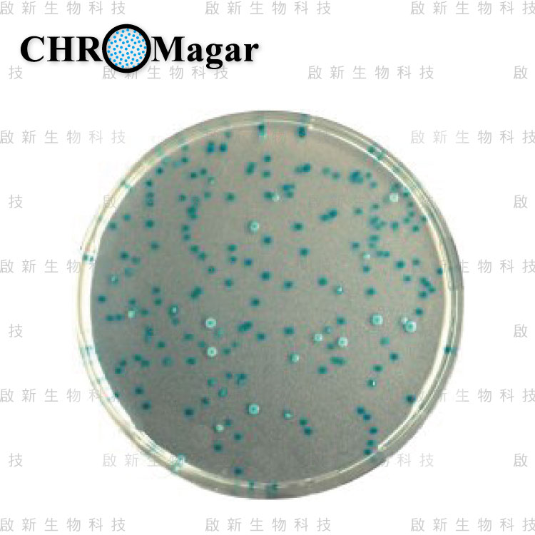 web_ChroMagar_E.coli