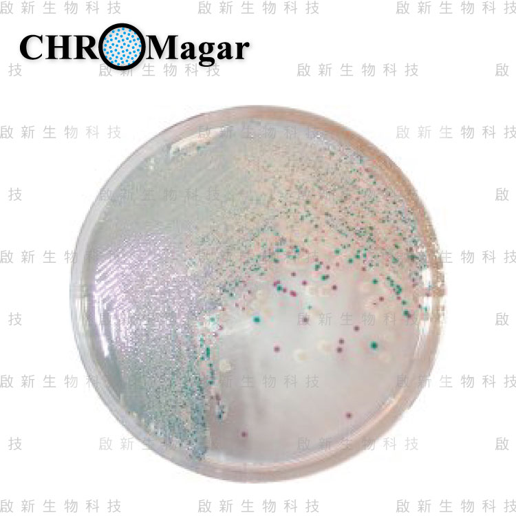 web_ChroMagar_Vibrio