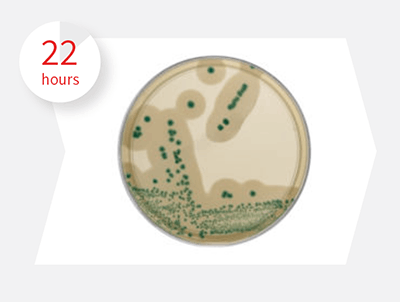 單核球增多性李斯特菌快速定量檢驗方法(Afnor國際認證) Listeria Precis Method |  啟新生物科技-生技醫療的領導品牌Creative