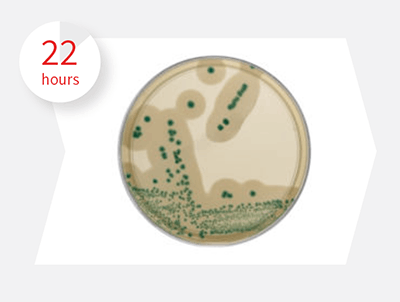 取0.1ml接種1片Brilliance Listeria Agar (BLA)