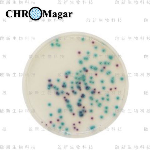 web_ChroMagar_Pseudomonas01