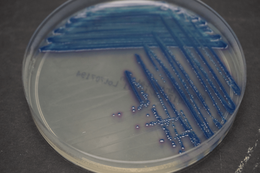 Chromogenic_agar-01